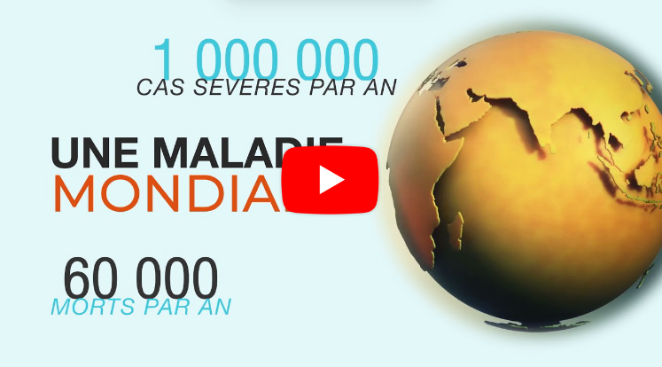 1 000 000 cas sévères par an