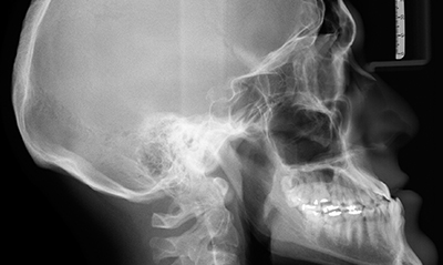 Tabliers de plomb médical Protège thyroïde rayon X dentaire 0