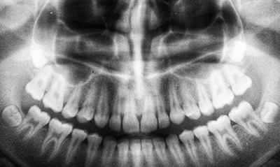 Radios et scanners : les rayons X en imagerie médicale sont-ils dangereux ?  - France Assos Santé